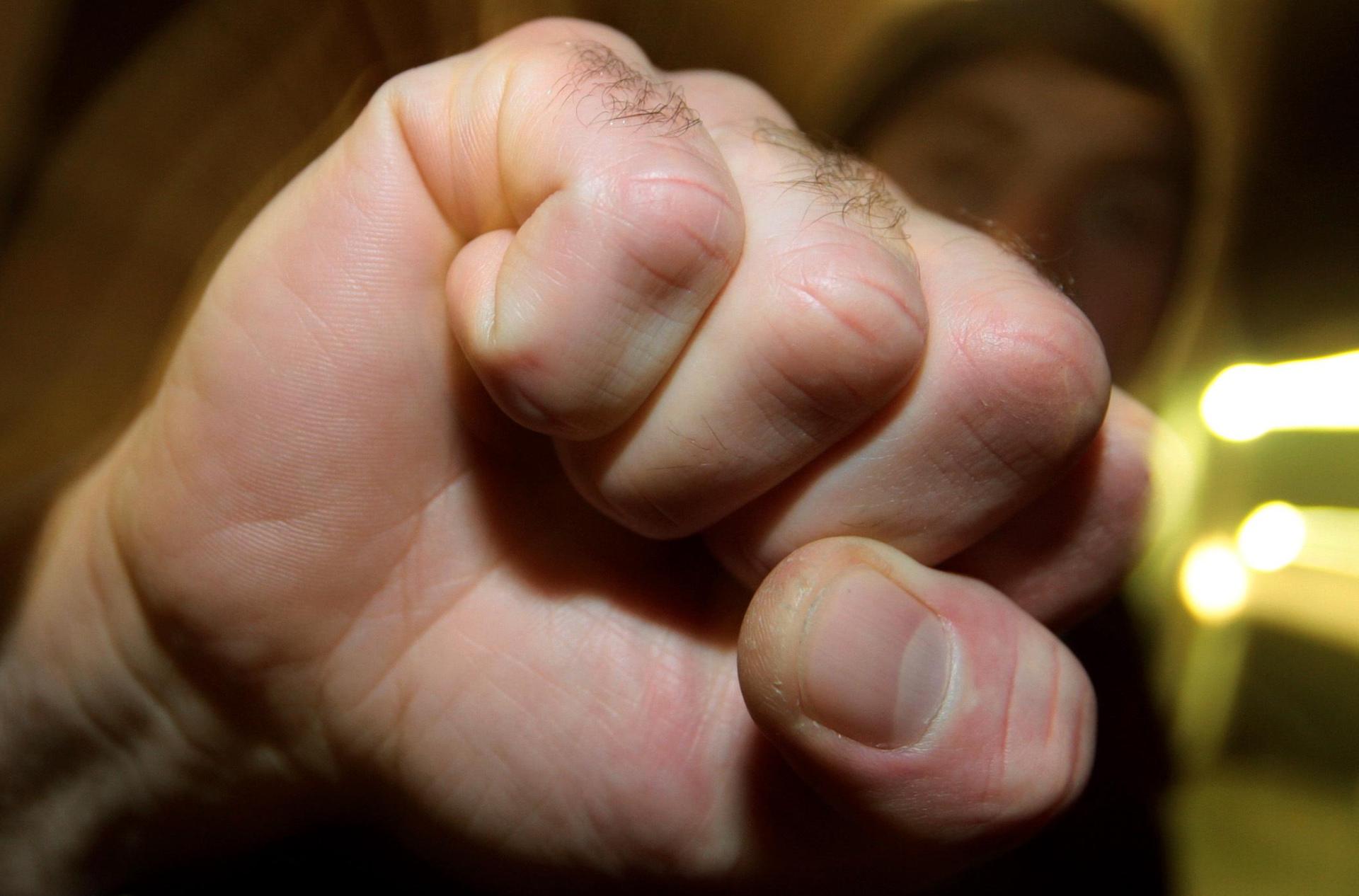 Die Polizeiinspektion Weiden sucht nach mehreren körperlichen Auseinandersetzungen in der Innenstadt Zeugen. (Symbolbild:  Karl-Josef Hildenbrand/dpa)